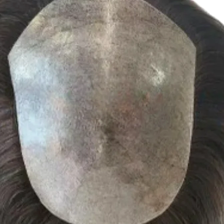Thin Skin hair system base