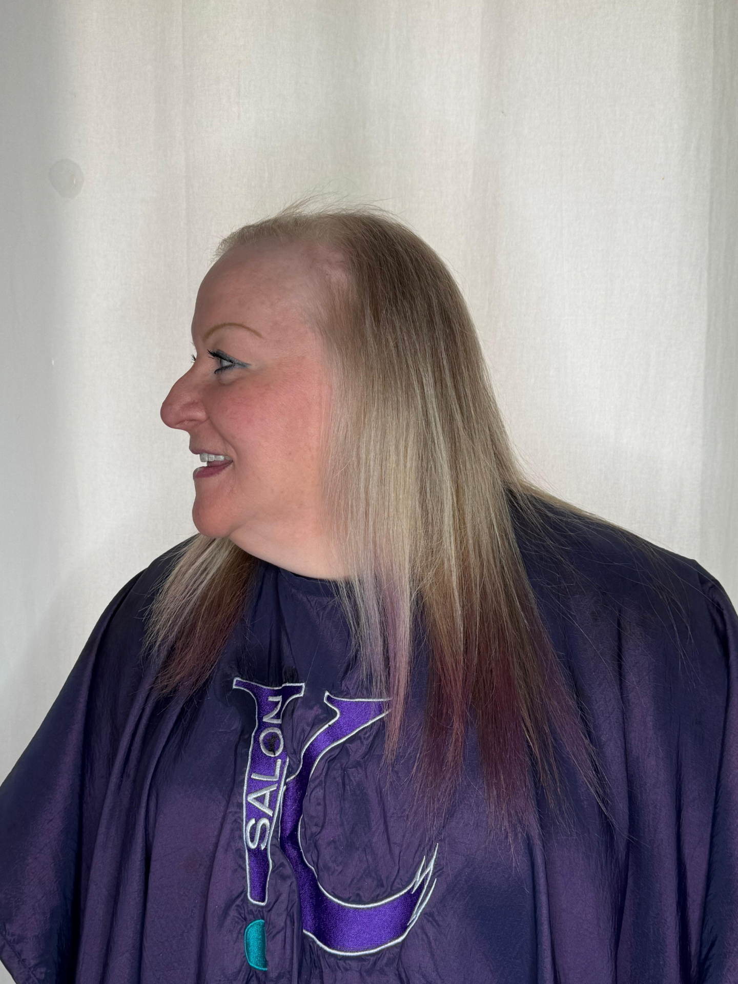 Client with thinning hair before Replica Scalp treatment