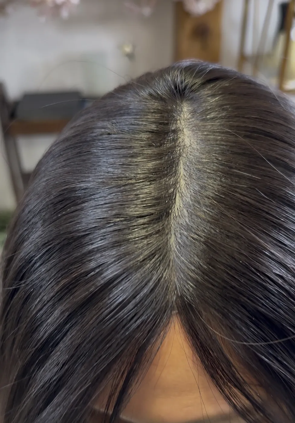 Natural Replica Scalp parting result